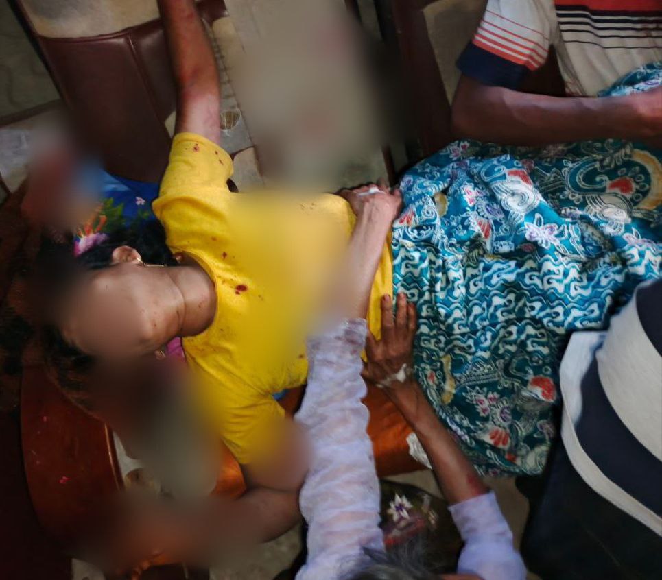 TRAC Incident Report: Military Council Landmine Explotes and Injures Three Civilians in Maungdaw Township, Rakhine State, Myanmar- 6 February 2025